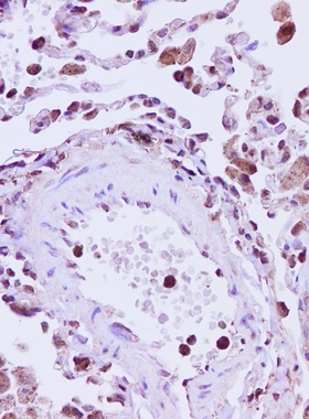 Elabscience® ANXA5多克隆抗体 E-AB-40249 适用免疫组化 200μL