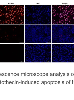 Elabscience®一步法TUNEL原位细胞凋亡检测试剂盒（红色 AF594）
