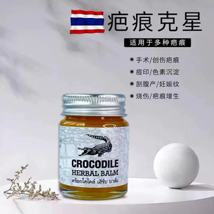 泰国鳄鱼膏原装正品进口去痘疤妊娠纹疤痕烫伤术后修复淡化鳄鱼油