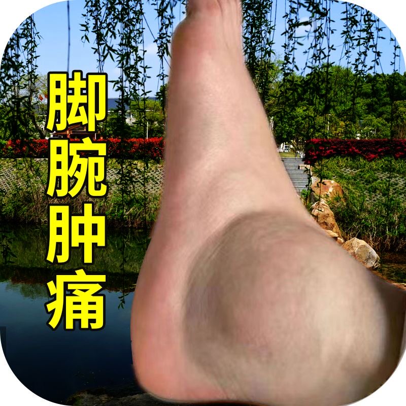 脚踝肿大疼痛膏药贴骨裂陈旧老伤关节肿大活血化瘀韧带拉伤