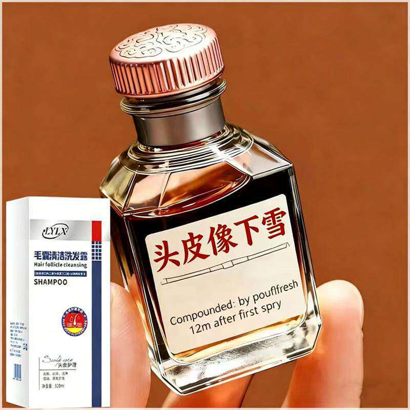 【小红书爆款】LYLX进口毛炎宁洗发水去屑止痒控油蓬松头皮清洁