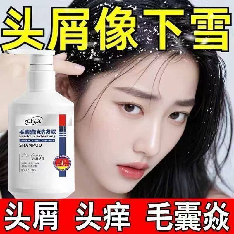 【山姆爆款】LYLX进口毛炎宁洗发水去屑止痒控油蓬松头皮清洁发露