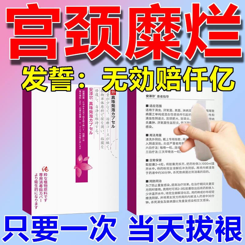 复方莪术油软胶囊乳酸菌阴道硝砆太尔制霉素片康妇特栓念珠菌性外