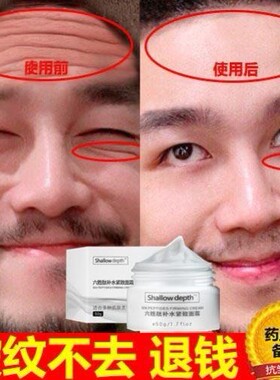 x抬头纹皱纹鱼尾纹改善男士提拉紧致六胜肽抗皱面霜老年人护肤
