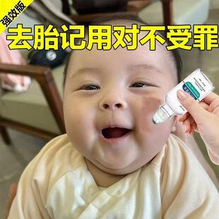 。儿童去胎记除胎记脸部神器黑色素青红太田痣咖啡斑专用精华液