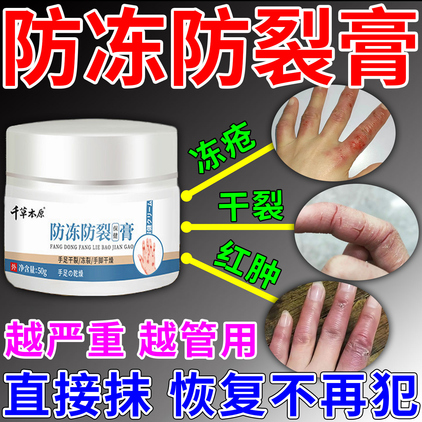 防冻防裂膏冻疮膏秋冬天防干裂手足耳朵脸冻伤皲裂专用保养修复霜