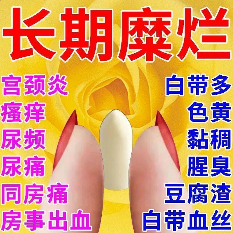 消糜栓正牌官方旗舰店阴道瘙痒治疗宫颈糜烂的药阴道炎妇科用药mj