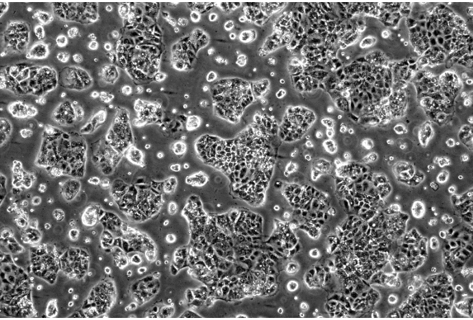 海星Caco-2细胞（STR鉴定正确）TCH-C146上皮样贴壁生长 人结直肠