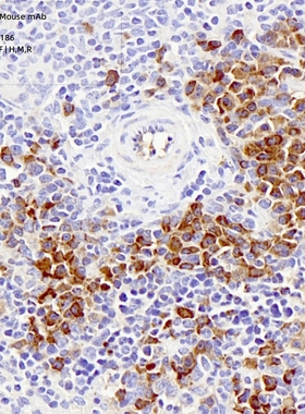 Servicebio抗-TLR4小鼠单克隆抗体,适用IHC/IF,应用种属H/M/R