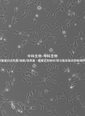 人脐静脉内皮细胞(HUVEC)培养基套装,STR鉴定免疫荧光鉴定,永生化