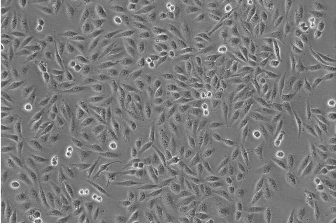 海星 TPC-1人乳头瘤甲状腺细胞（STR鉴定正确）上皮样 贴壁生长