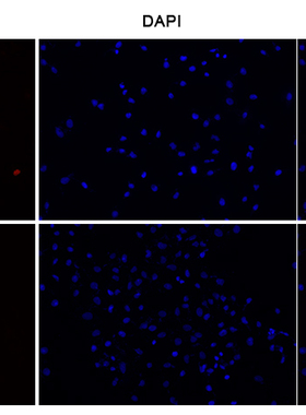 E-Click EdU细胞增殖成像检测试剂盒（红色，Elab Fluor® 594）