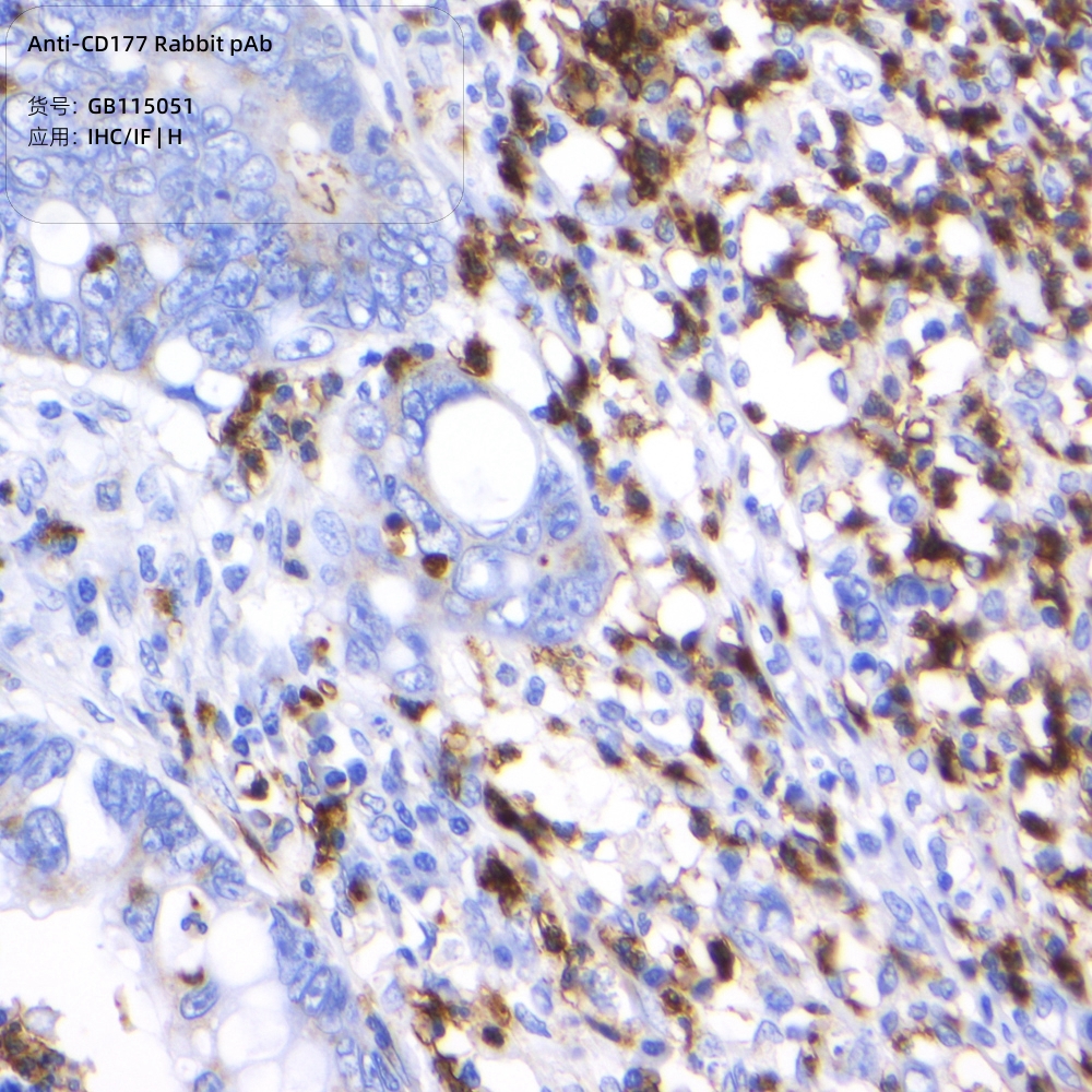 Servicebio抗CD177兔pAb抗体,Anti-CD177 Rabbit pAb,适用IHC/IF