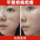 北京黑布疤痕膏胸口疙瘩凸起烫伤软化淡化平复疤痕体质