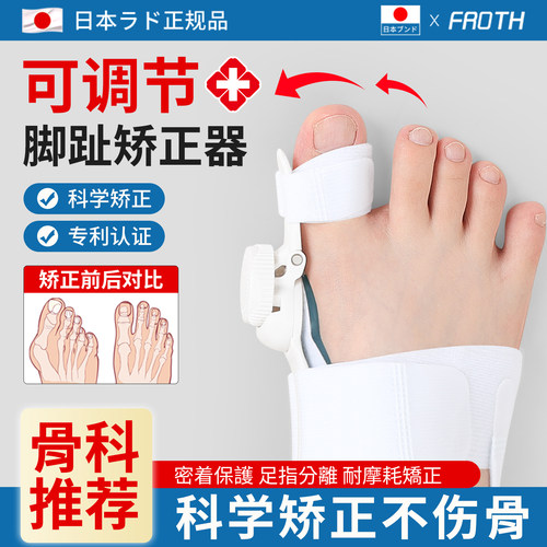 脚趾矫正器】大拇指外翻分趾矫正