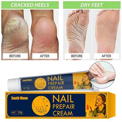 速发Anti+Crack+Foot+Cream+Drying+Cracked+Peeling+Feet+Repair