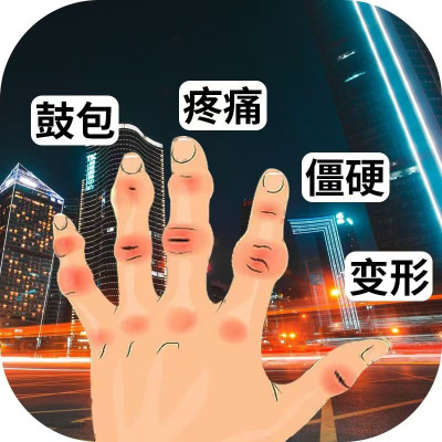 手指关节粗大美手修复矫正肿大变形僵硬疼痛变细变长专用