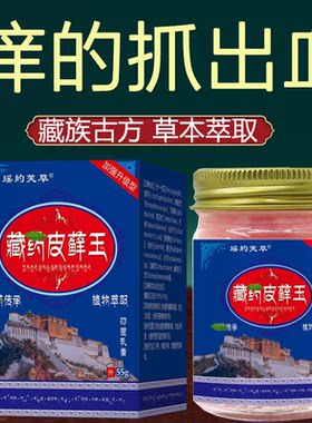 藏药皮藓王牛皮药膏头皮股银去屑病皮肤杀菌症止痒抑菌正品专用癣