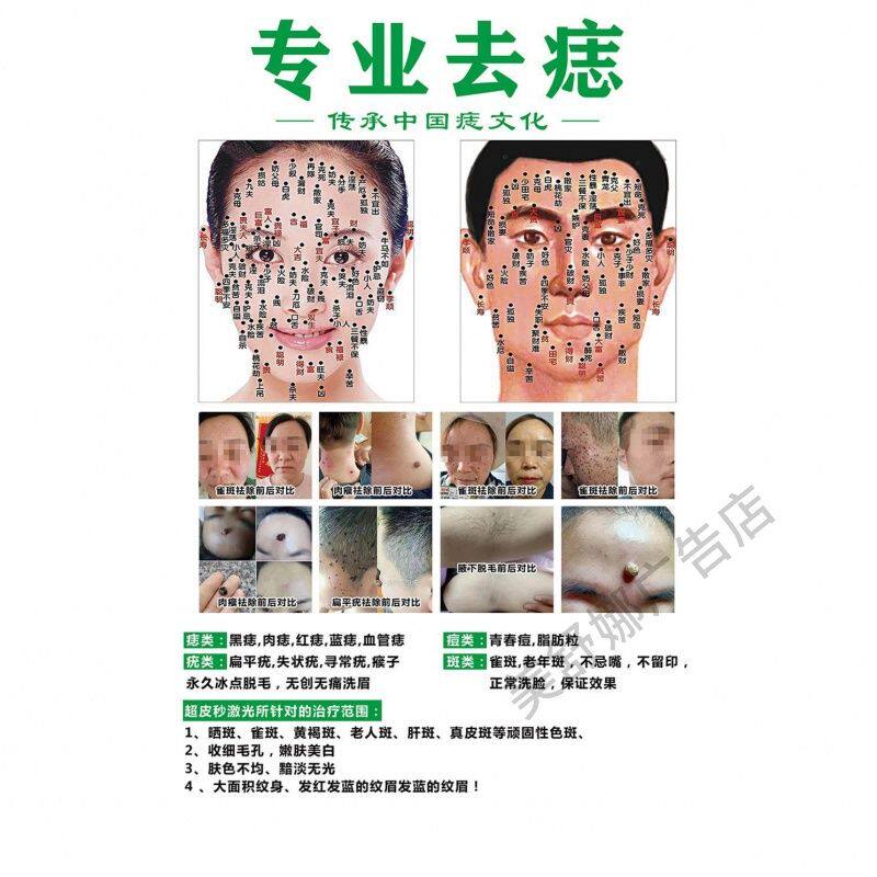 点痣美容院养生馆装饰画点痣祛疣广告海报KT板贴画海报自粘墙贴画