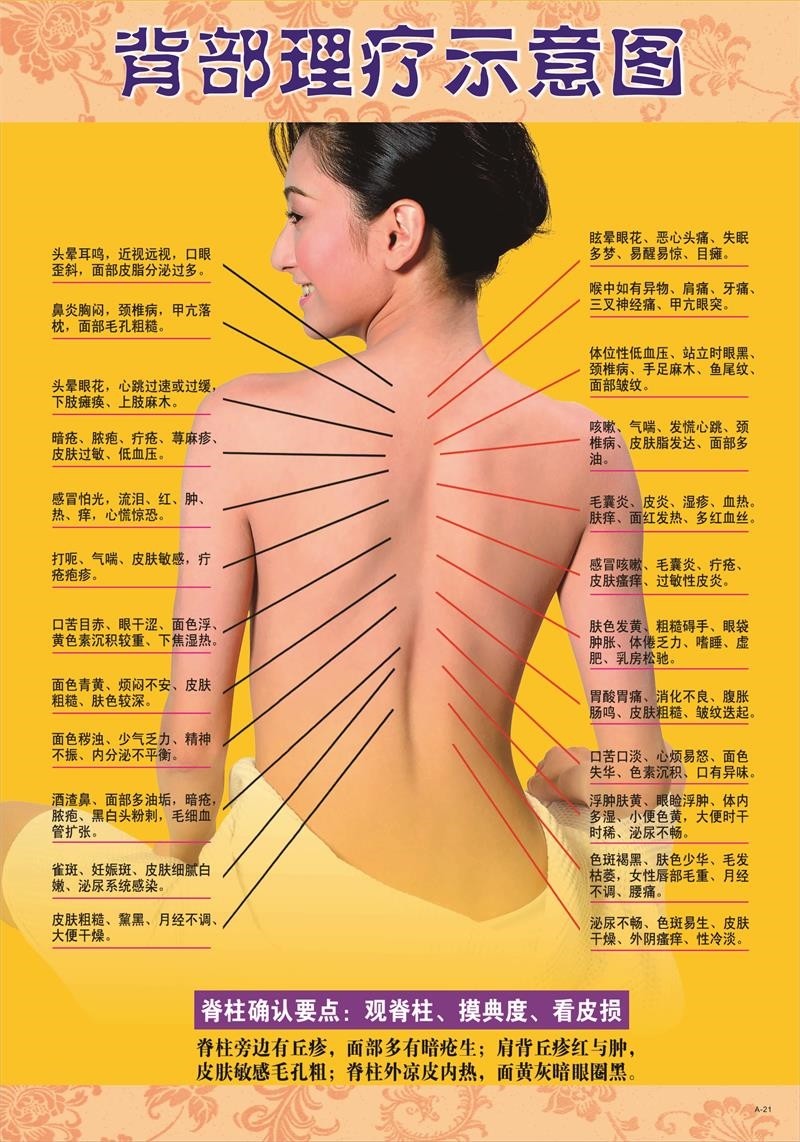 背部理疗示意图墙贴纸美容院养生馆背部刮痧示意图好处经络图海报