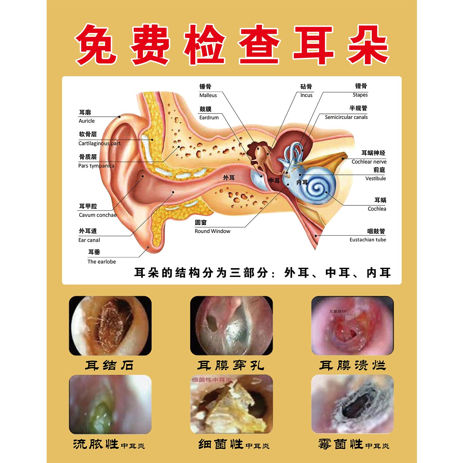 采耳图片中耳炎海报免费检查耳朵常见耳病症状挂图采耳店装饰画