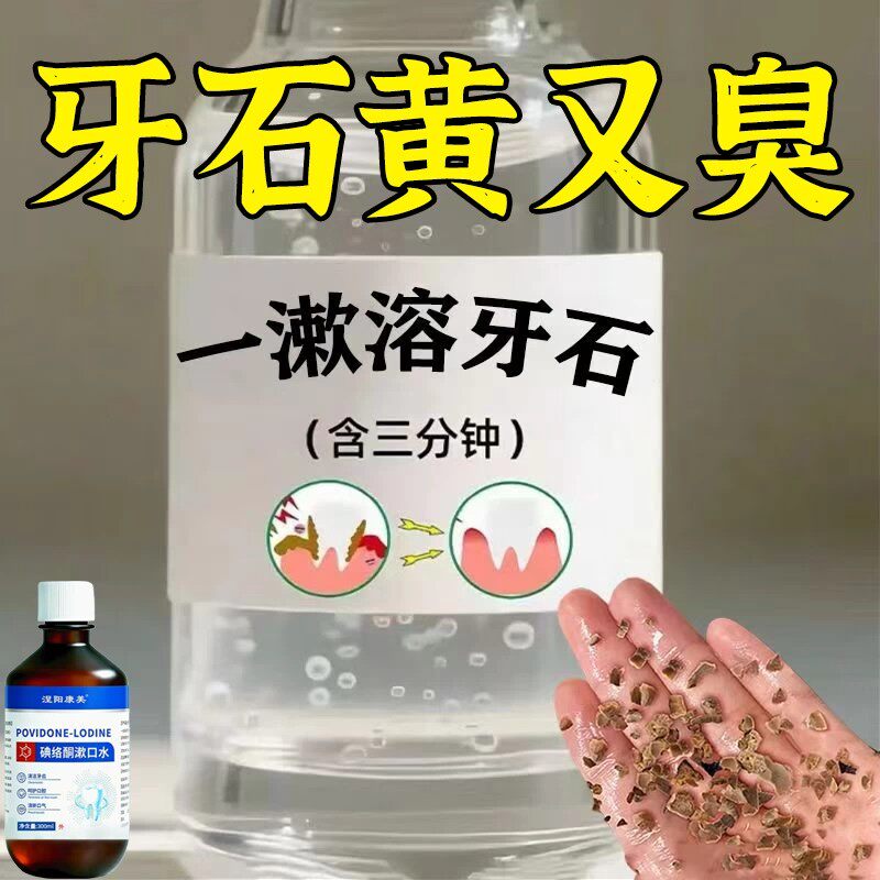 【重度牙结石】牙黄牙石溶解漱口水洗牙齿污垢牙垢牙黄牙渍清理