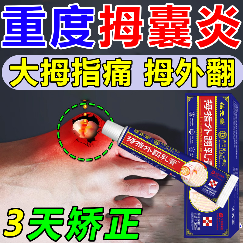 拇囊炎拇指外翻膏大拇指疼痛大脚骨关节畸形矫正拇囊炎专用膏