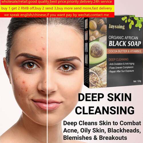 organic african black soap oil acne skin blackhead blemishes