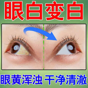 眼白清澈去黄修复眼球发黄红血丝干涩浑浊药水黄斑病变护眼滴眼液