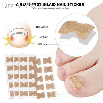 Ingrown Toenail Sticker Nail-Corrector Foot-Care Glue