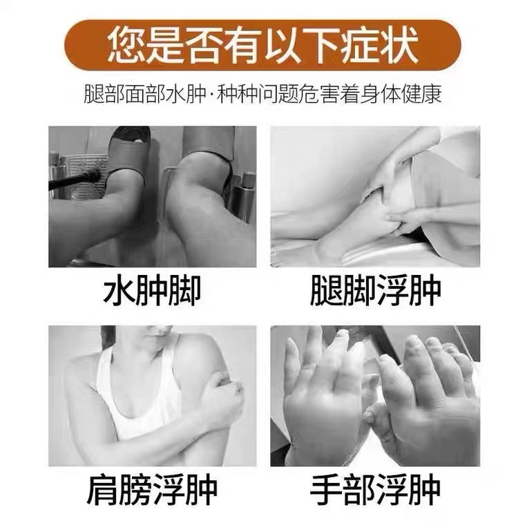 特效消水肿药利尿排水肿成人老人快速消脸部肿腿肿去下肢水肿神器