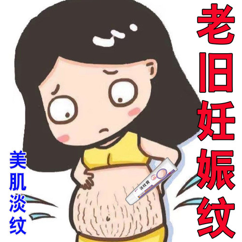 妊辰纹淡化乳膏去腹部妊娠纹生长纹肚子肥胖纹产后肚子黑线修护膏