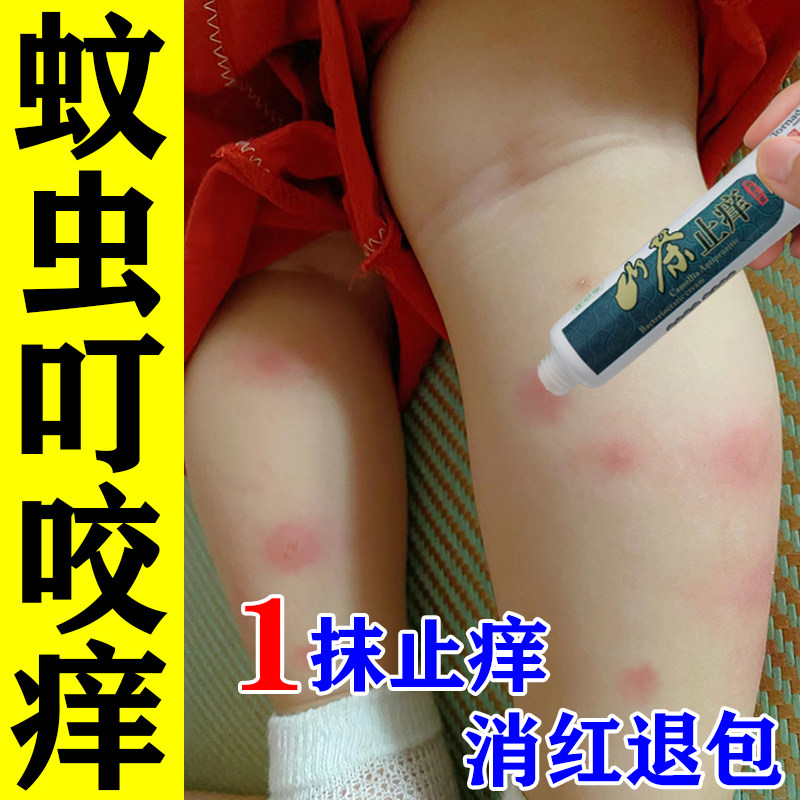 蚊虫叮咬止痒消红肿儿童跳蚤蚊子蚂蚁毒虫咬皮肤瘙痒红肿止痒药膏