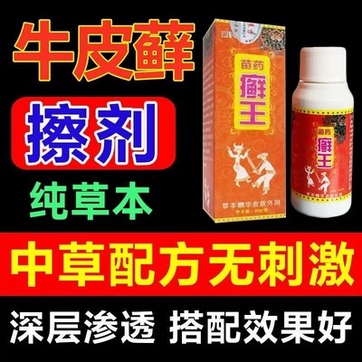 苗药癣王顽固性牛皮藓药水银屑病止痒皮肤真菌感染鳞屑皮炎铜钱癣