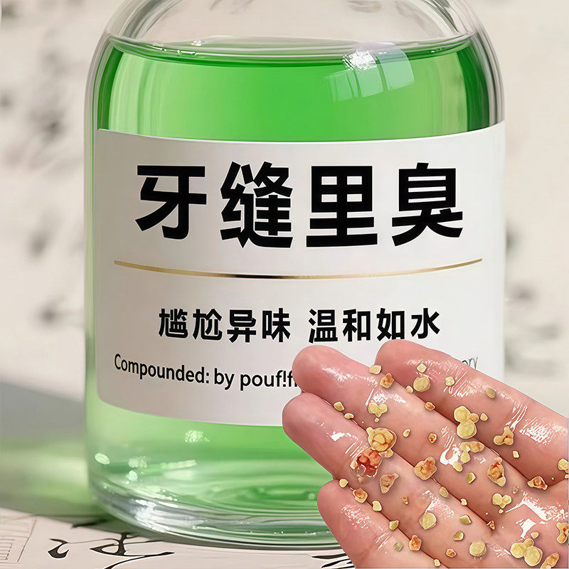 【德国专研】牙石溶解漱口水洗牙齿污垢牙垢牙黄牙渍清理神器