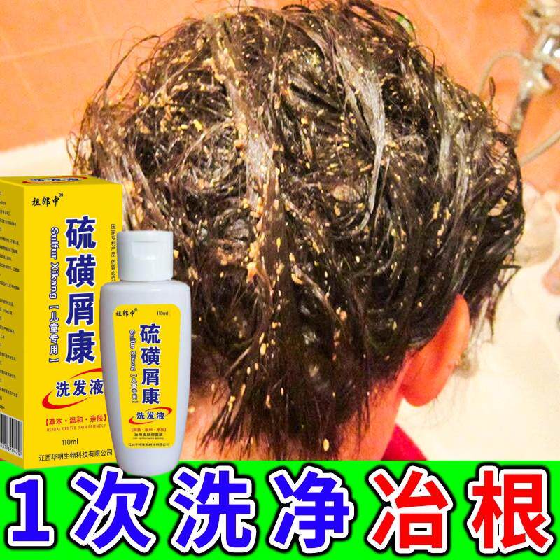 硫磺洗发水剪发虫洗发水除螨虫药儿童治小孩头上长虱子跳蚤去头屑