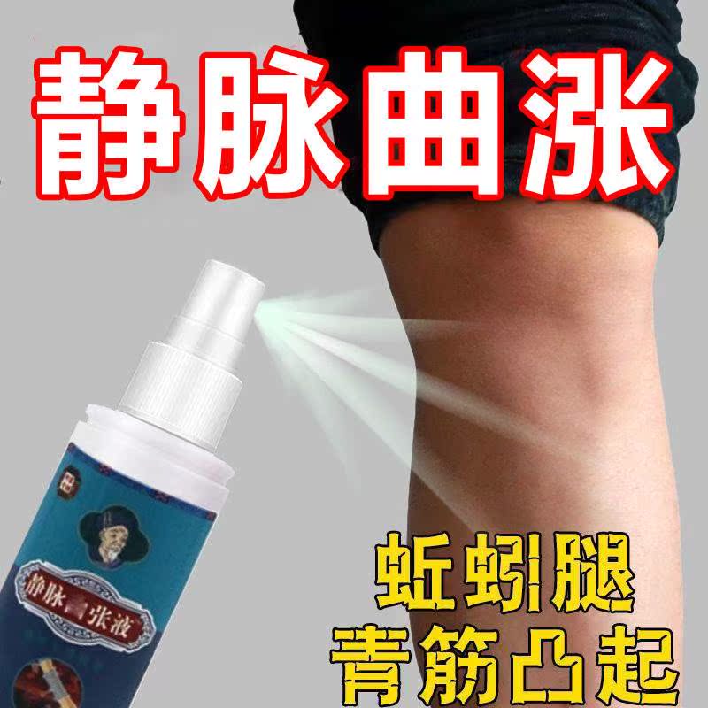 【不用二次】静脉曲涨特效膏血管青筋凸起红血丝蚯蚓腿去疼痛麻CS