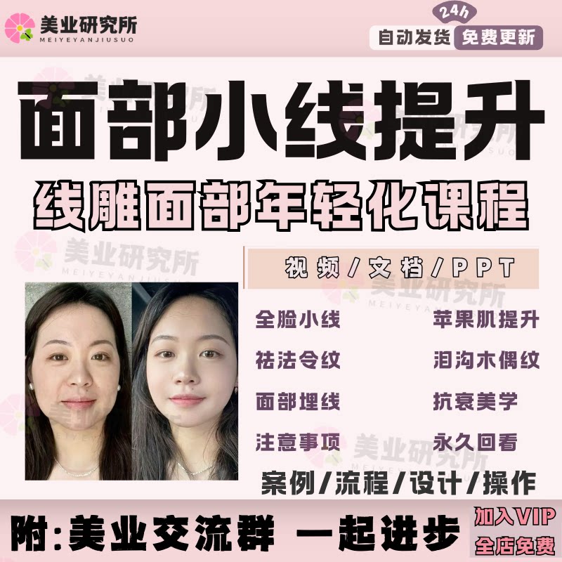 小线面部埋线苹果肌提升木偶祛法令纹线雕年轻化抗衰线雕视频教程