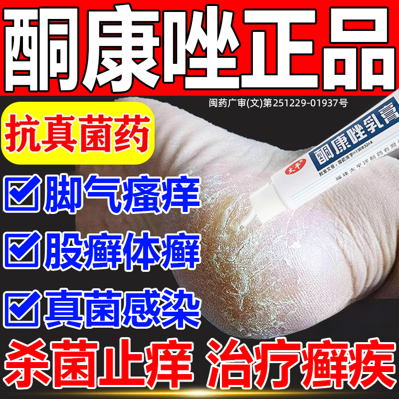 【太平】酮康唑乳膏2%*10g*1支/盒手癣足癣股癣体癣花斑癣