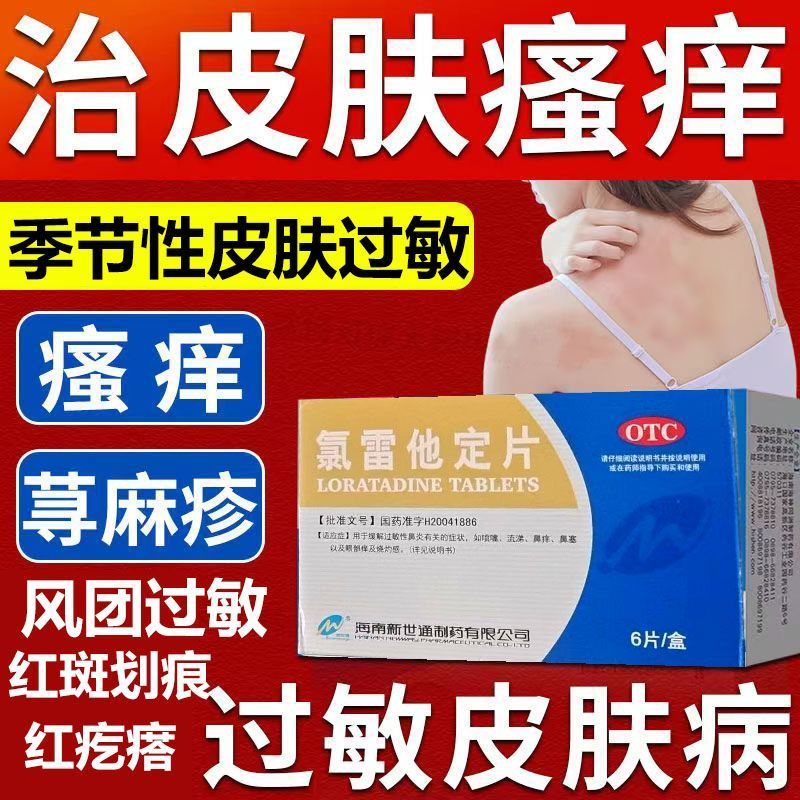 【Newway/新世通】氯雷他定片10mg*6片/盒过敏性鼻炎慢性荨麻疹鼻塞喷嚏荨麻疹