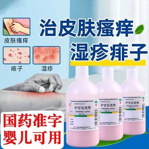 【信龙】炉甘石洗剂5%5%15%*100ml/瓶痱子湿疹荨麻疹皮肤瘙痒瘙痒