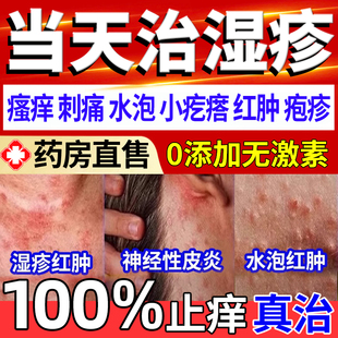 自營 濕疹藥膏止癢去根陰囊潮濕瘙癢男人特效藥外用頑固皮炎膏