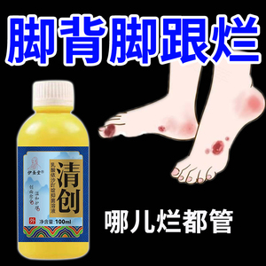 脚底脚面烂摔伤口清创液创面流脓术后感染久不愈合专用玉红生肌膏