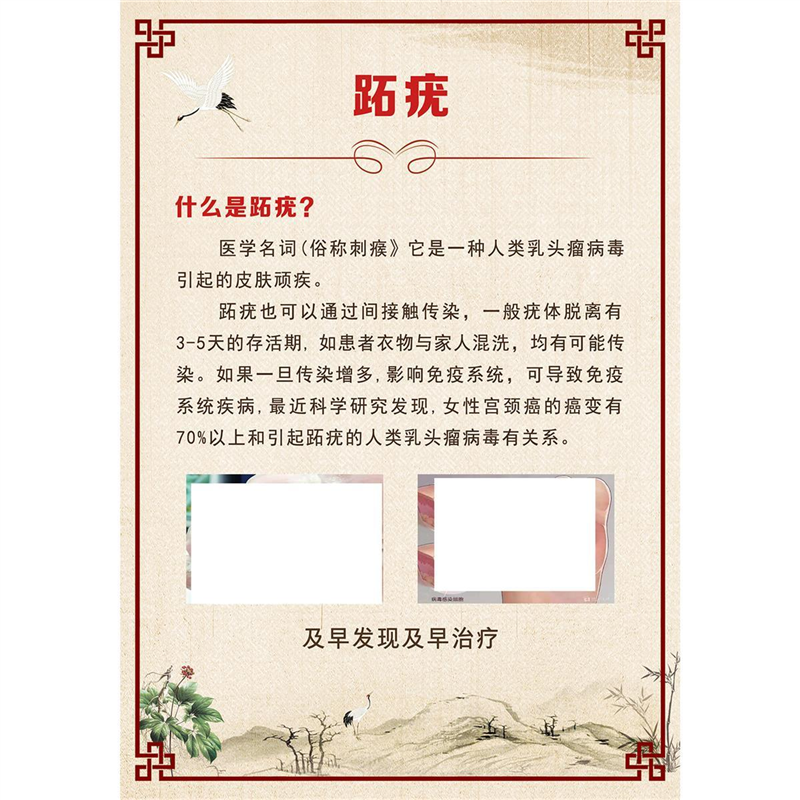 跖疣海报灰指甲店挂画手脚常见病墙贴皮肤病图解自粘装饰画修脚店