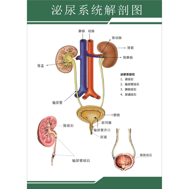 医院人体泌尿系统结构示意图海报 泌尿系结石挂图 泌尿系统解剖图