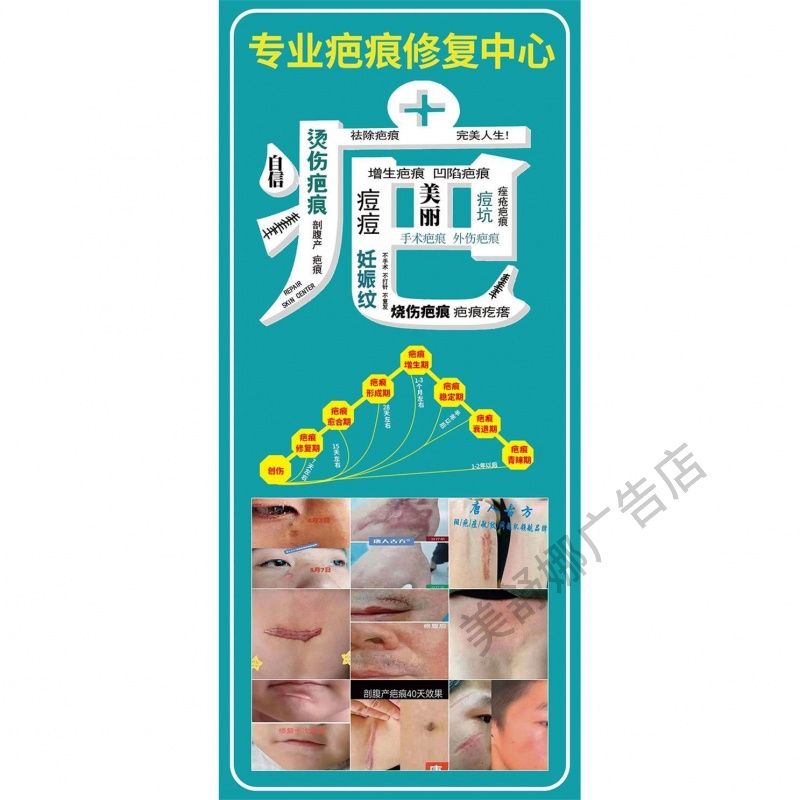 疤痕祛斑祛痘广告海报疤痕痘坑妊娠纹修复痘印美容墙壁宣传贴画图