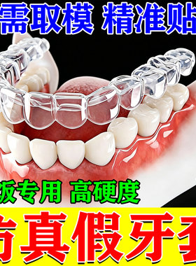 牙套通用吃饭神器成人永久仿真磨牙活动假牙义齿遮丑缺牙临时通用