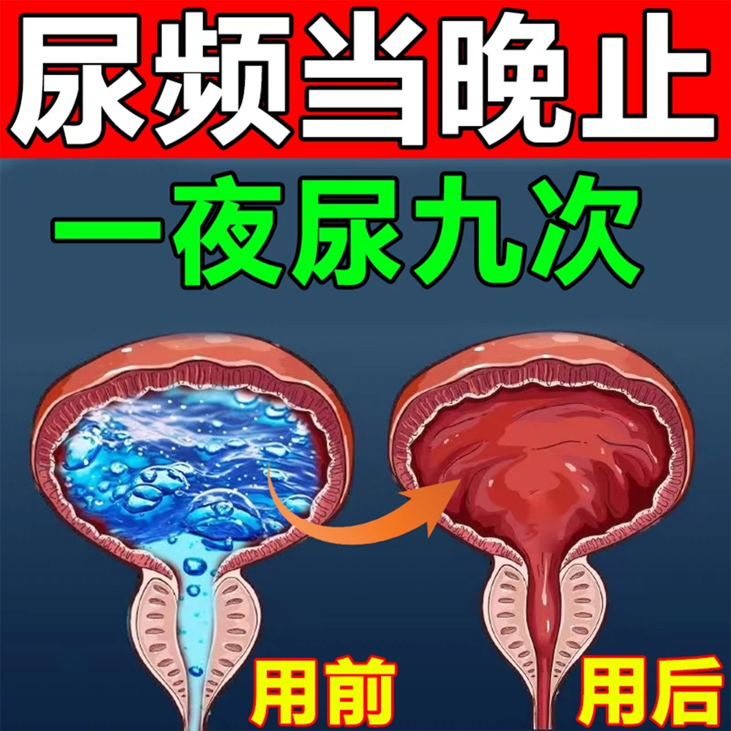 尿频尿急夜尿多小便次数多憋不住尿不尽尿痛男女肚脐专用中草药贴