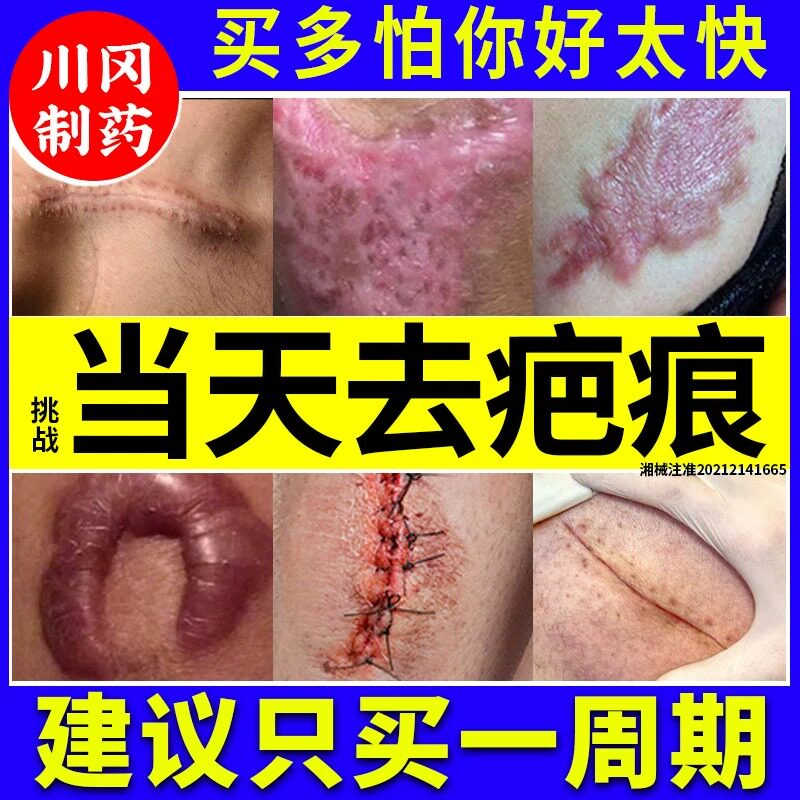 日本进口疤克祛疤膏巴克去疤痕修复除疤膏儿童烫伤官方旗舰店正品