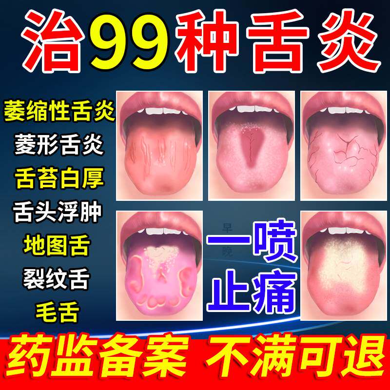 舌炎喷雾舌苔白厚舌头生疮起泡上火发炎开裂口腔溃疡专用薬立康MZ